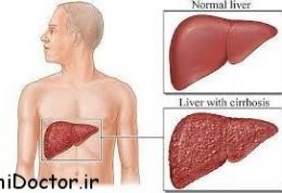 اطلاعات کامل درباره بیماری هپاتیت و درمان آن