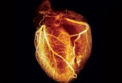 روش‌هایی دقیق برای بررسی رگ‌‌های اصلي قلب