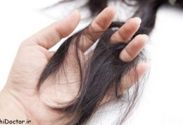 مشکلات مو را چگونه درمان کنیم؟