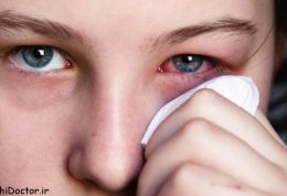 روش درمان خانگی عفونت چشم
