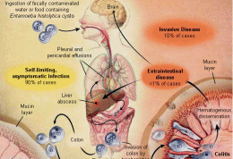 آمیبیازیس چه بیماری است؟ نحوه درمان آن چیست؟
