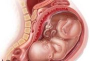 چگونه در دوران حاملگی یبوست را درمان کنیم