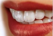 آیا کاربرد فلوراید به تنهایی برای جلوگیری از پوسیدگی دندانها کافی است؟