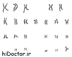 تعریف کاریوتایپ را باهم مرور میکنیم