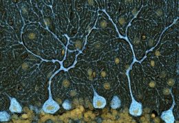 ” نقشه حرکت ” در مغز ،نقش سلولهای مخچه و اثر تخریبی الکل