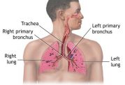 سندرم زجر تنفسی حاد چه نوع بیماری است؟
