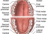 پوسیدگی دندان به چه علتی بوجود می اید؟