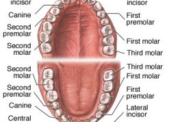 پوسیدگی دندان به چه علتی بوجود می اید؟
