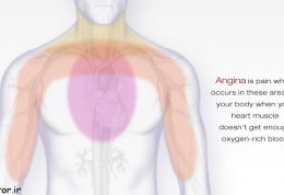 درد قلبی  چیست و علائم و درمان آن چگونه است