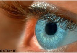 مروری بر بیماری چشمی دژنراسيون ماکولا