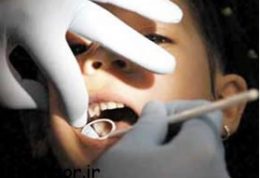 افراد چاق زودتر به پوسیدگی دندان مبتلا می شوند