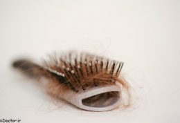 چگونه با طب سنتی ریزش موی سکی را درمان کنیم