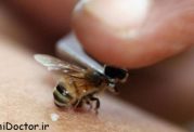 درمان نیش زنبور عسل با میوه ها