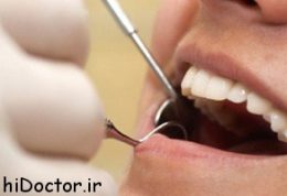 مختصری در مورد ترمیم های دندان