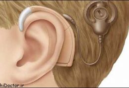 روش جدیدی برای درمان ناشنوایی
