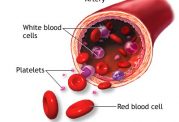 کم خونی فانکونی چه نوع کم خونی است؟