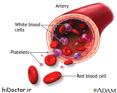 کم خونی فانکونی چه نوع کم خونی است؟