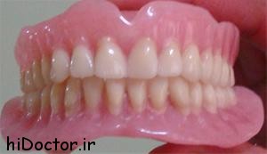 دانستنی هایی درمورد دندان مصنوعی متحرک
