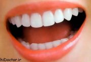 از پرکردگی رنگ دندان چه می دانید؟