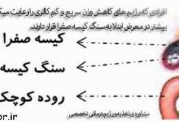 ارتباط رژیمهای کم کالری با سنگ کیسه صفرا