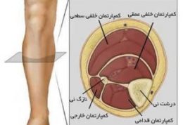 همه چیز را درباره سندرم کمپارتمان بدانیم