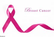 تفسیر گرید  4 بودن سرطان پستان