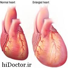 فاکتورهای ارثی بودن بزرگی قلب