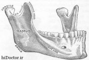  تحلیل استخوان‌ فک  در جاهایی که هیچ دندانی وجود ندارد
