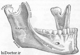 تحلیل استخوان‌ فک  در جاهایی که هیچ دندانی وجود ندارد