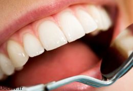 چرا جرم گیری کردن دندان ترسناک است