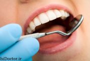 فرسایش دندان به چه دلایلی بوجود می آید