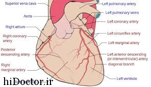 در رابطه با جراحی شریان کرونر چه مواردی را باید بدانید