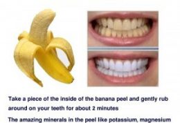 درباره سفیدی دندان با پوست موز چقدر اطلاعات دارید؟