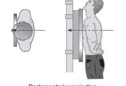 رادیوگرافی قفسه سینه بطور مقدماتی چگونه تفسیر می شود