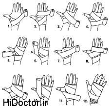 روی دست و پا را چگونه باند پیچی کنیم