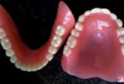  آمار باورنکردنی استفاده ایرانیان از دندان مصنوعی 