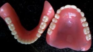 آمار باورنکردنی استفاده ایرانیان از دندان مصنوعی
