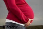  نوارهای سفید روی شکم بعد از بارداری