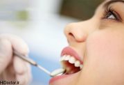 درمان خشکی دهان را یاد بگیرید