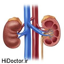 کاهش خطر نارسایی کلیوی با کاهش هموگلوبین A1C