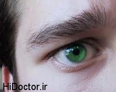 عوارض  درمان سرخود ناخنک چشم