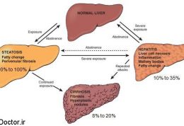 مهمترین اختلال کبدی در ایران
