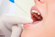با بی‌حسی دندان‌پزشکی بیشتر آشنا شوید