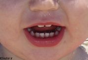 نشانه های سلامت دندان کودک