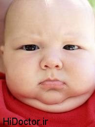نوزادان سزارینی از نوزادان طبیعی چاق ترند