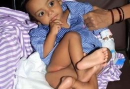 گزارش تصویری از ناهنجاری در بدو تولد