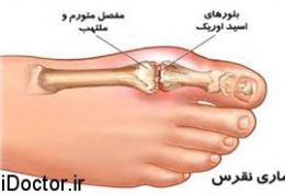 شصت پا و درد و تورمش را جدی بگیرید