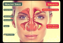 سینوزیت با شما چه می کند
