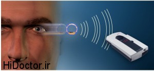 ایمپلنتی برای اندازه گیری فشار چشمها