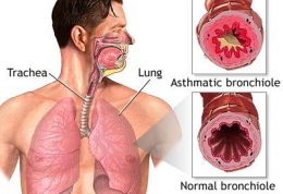 افراد با تحرک کم تنگی نفس می گیرند